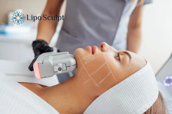HIFU vs Botulinum Toxin: Understanding the Differences 1 HIFU vs Botox Calne What is the best option for you?
