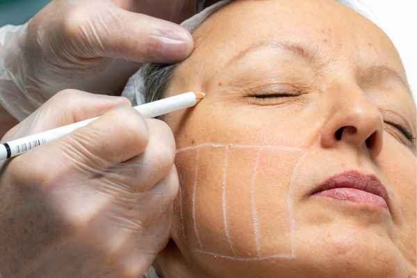 CryoPen: 5 Skin Concerns It May Be Used to Treat 4 What should you ask before having CryoPen treatment Calne?