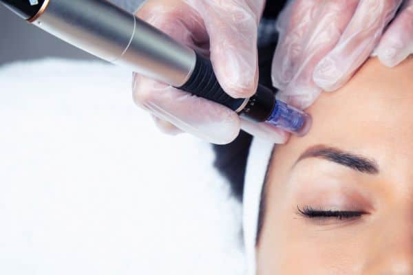 Explaining Total Skin Tightening Treatment and What to Expect 2 What Skin Concerns Can Total Skin Tightening Treatment Help With Calne?